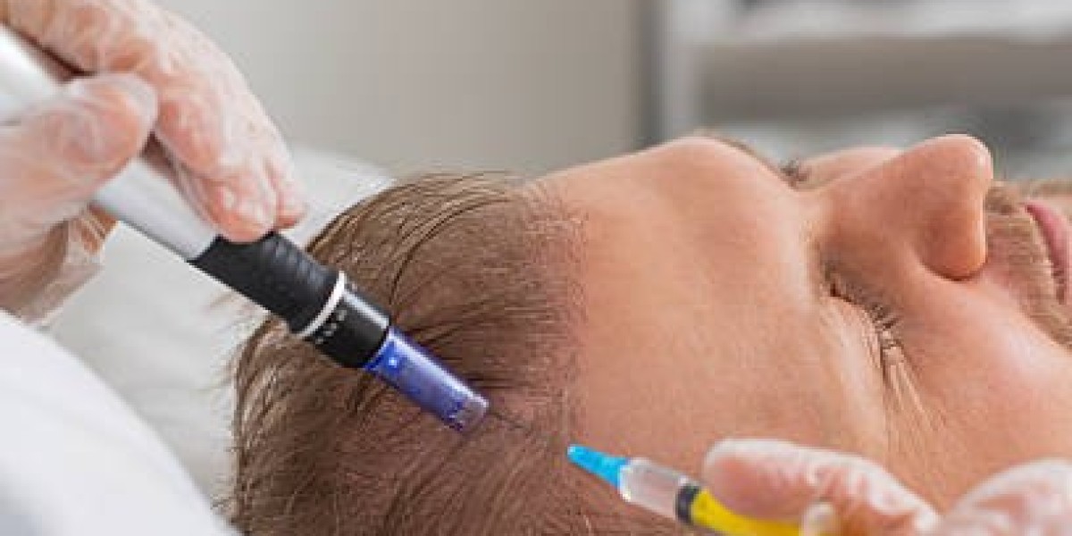 The Future of Hair Loss Treatment: The Power of Exosomes