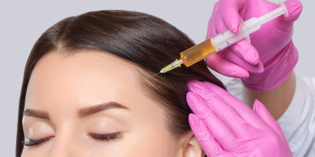 PRP Treatment Breakthroughs for Fuller Hair in Riyadh